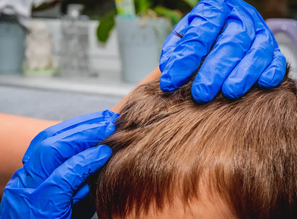 boy having his head checked by a lice professional maryville illinois